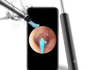 Ear Wax Removal Endoscope Otoscope