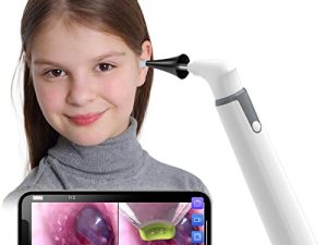 Wireless Otoscope Ear Camera with Dual View